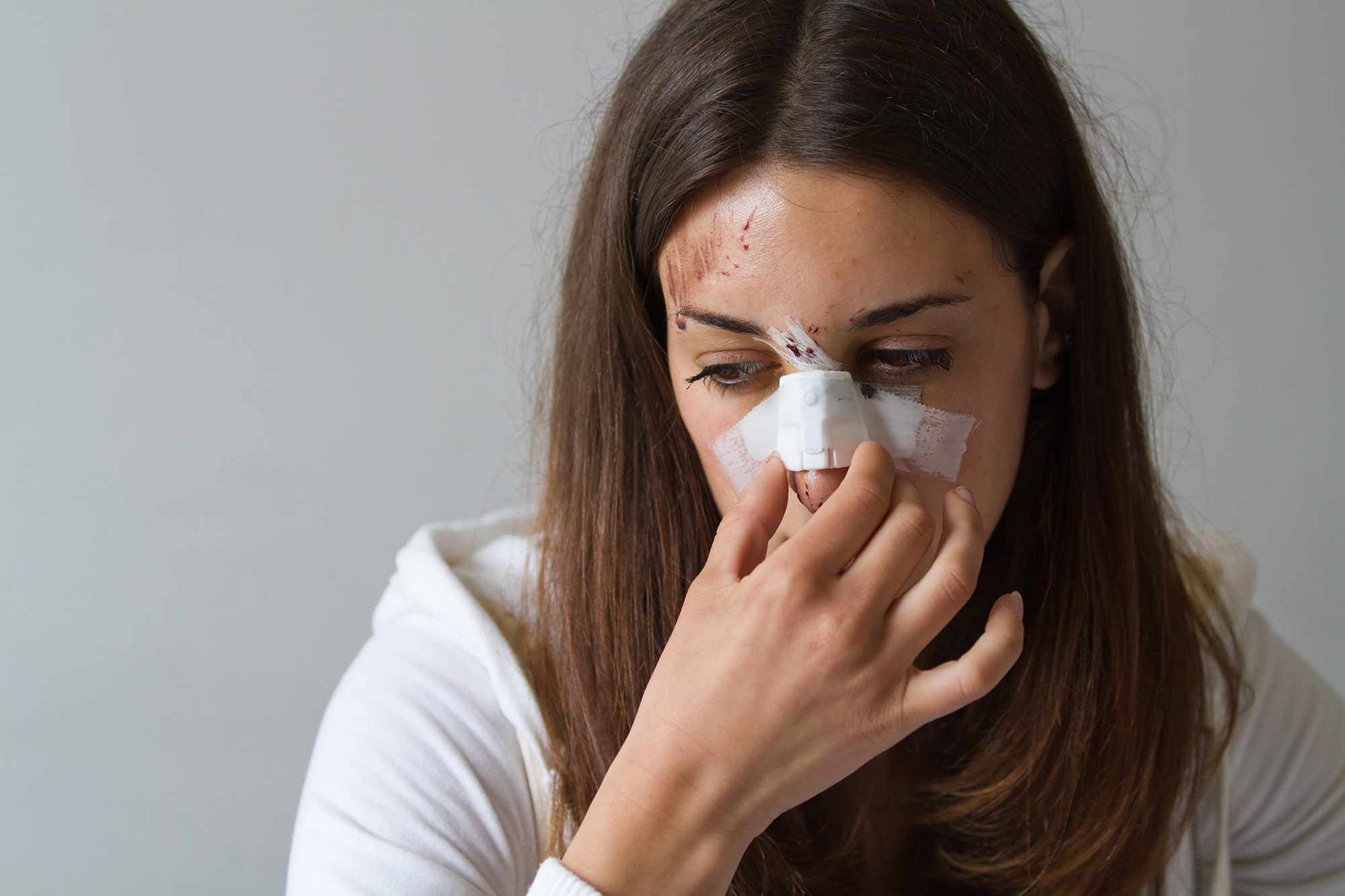 broken nose personal injury compensation claims solicitors Aberdeen