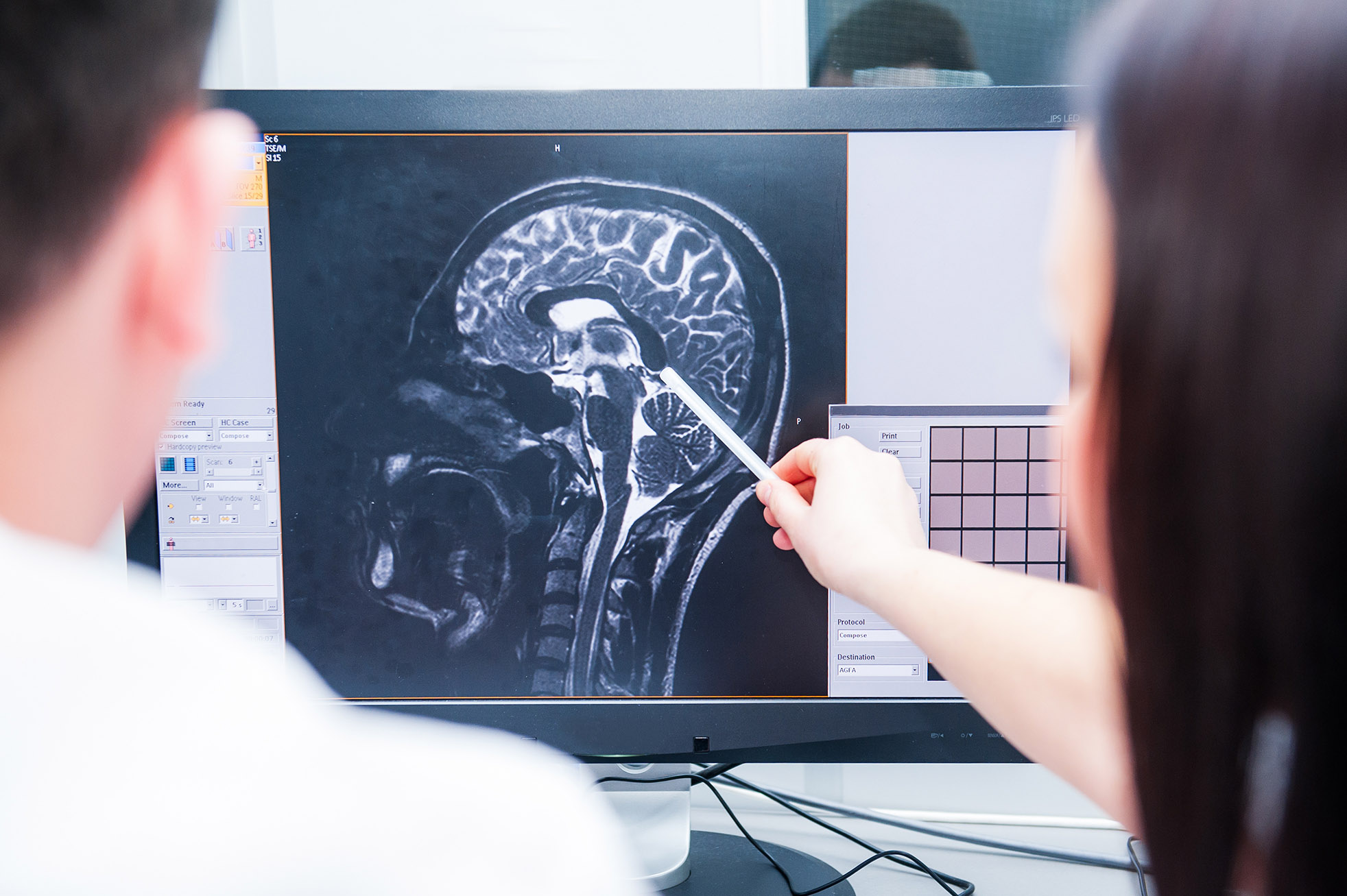 medical brain scan negligence misdiagnosis compensation claims Aberdeen